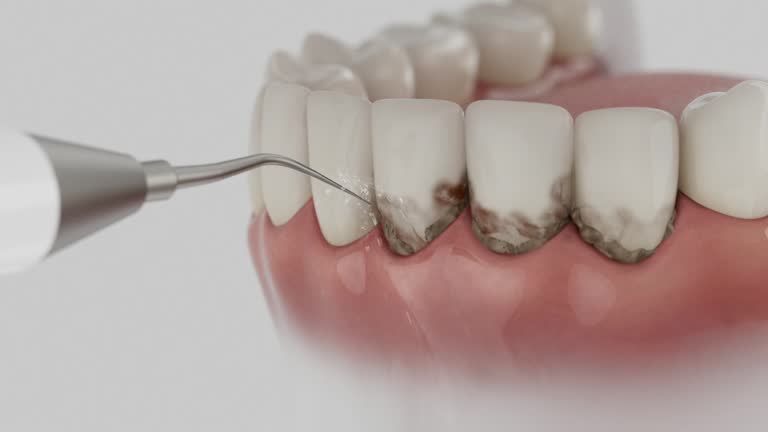 Trusted Invisalign Clear Aligners service in Wetumka, OK - Dentist Open Now